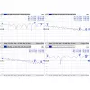 Kaabel Mmcx RPSMA-le/ACMMCXRPSMA Mikrotik