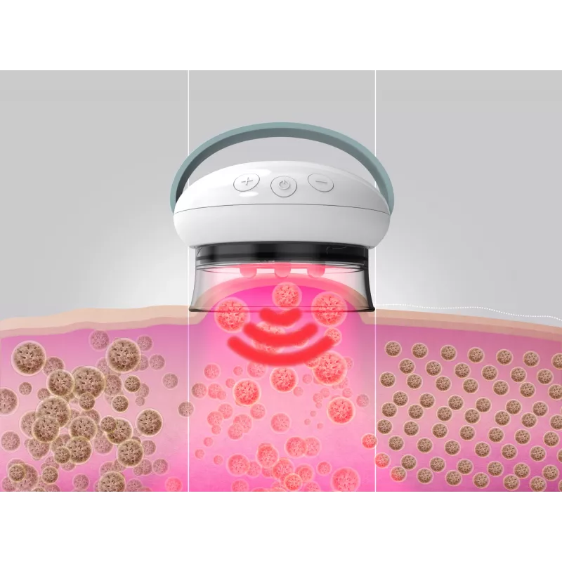 HoMedics Smoothee IR jalamassaažiseade Valge 4 peaga Akutoide