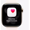 Nutikell Apple Watch Series 11 GPS + Cellular 46mm titaankorpusega