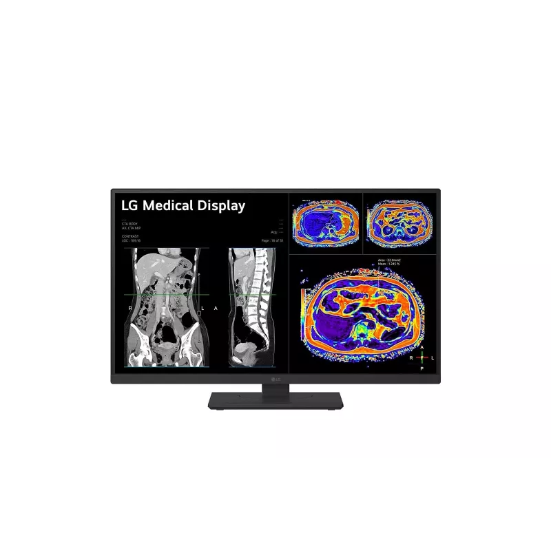 LG 27HS713C-B arvutikuvar 68.6 cm (27 tolli) 3840 x 2160 pikslit 4K Ultra HD LED Must