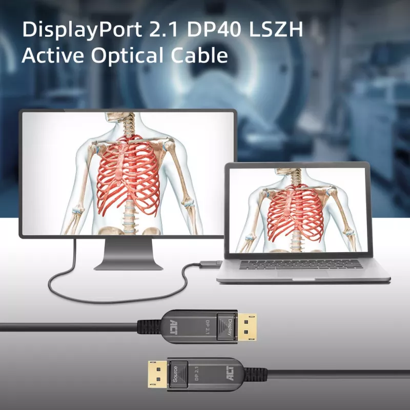 ACT AK4171 DisplayPort kaabel 15 m Must