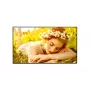 LG 75UL5Q-M 75-tolline standardne keskmine UHD-ekraan koos webOS 6.0-ga