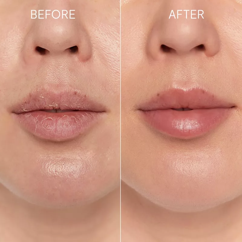 GLOV Scrubex Lip Exfoliating Mitt - 2 Pack | Õrn mikrokiud huulekoorija siledatele huultele