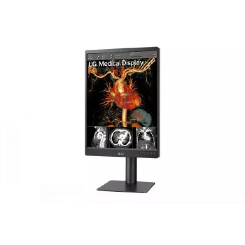 LG 21.3 inch 3MP IPS Diagnostic Monitor 21HQ513D-M