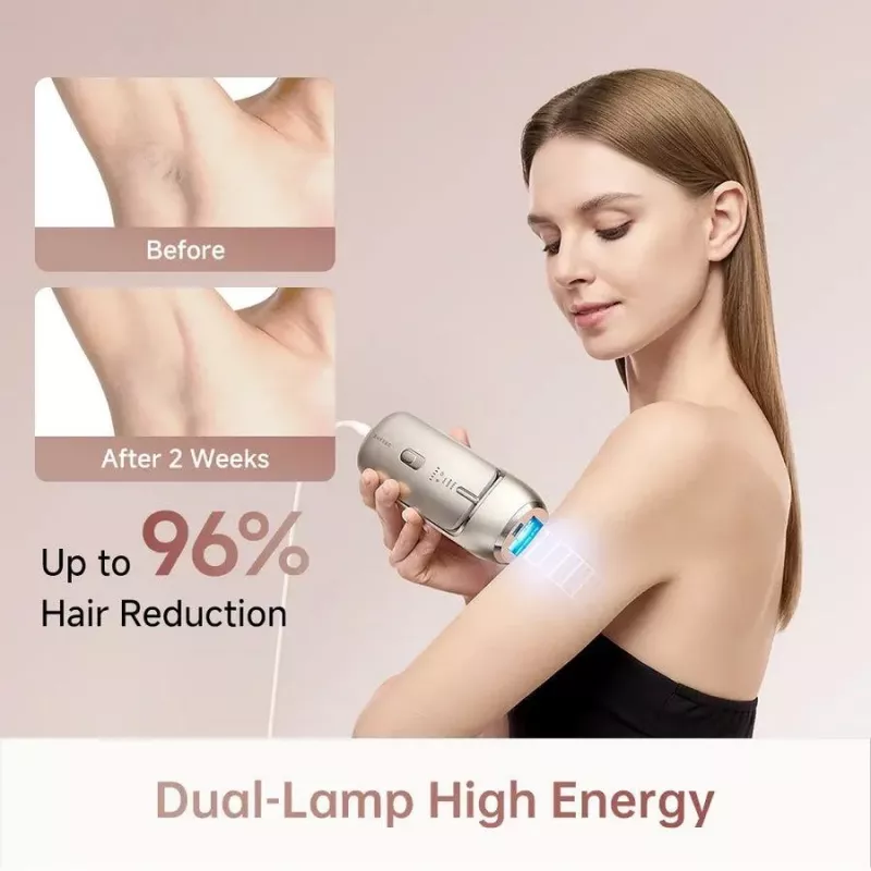 Dreame AHR01-GOLD IPL karvade eemaldamise seade Nova Gold, 990 000 välku, 5 energiataset, UV-filter, juhtmega